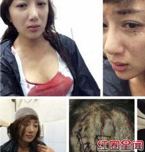 ​叶璇经纪人回应宠物狗咬伤女星李依晓事件始末