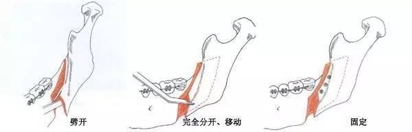林允儿无修图越来越美（把范冰冰杨幂都KO下去的林允儿）(23)