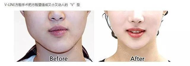 林允儿无修图越来越美（把范冰冰杨幂都KO下去的林允儿）(22)