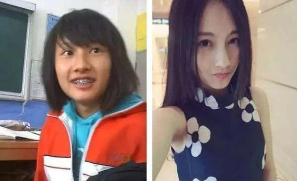 整容院图片,为什么都说大学是一座“整容院”图4