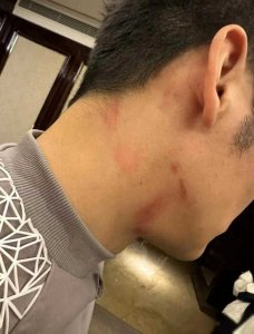 ​李晨的脖子成了亮点！吻痕还是勒痕？一目了然