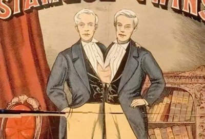 ​暹罗连体兄弟在美国暴富，娶英国姐妹花，生21个子女，同一天病逝