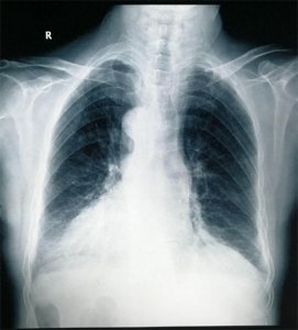 ​何为“镜面人”？