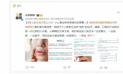 ​不一定是“上火”！嘴上总起水泡，可能是它在作怪