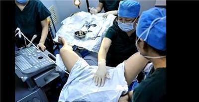 试管婴儿在子宫内的着床过程，有图有真相——看了真为准妈妈揪心